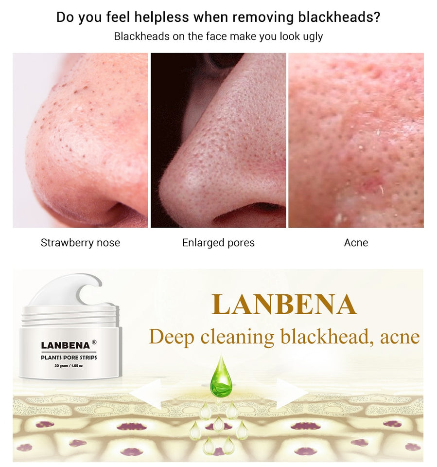 Acne Treatment Mask Skin Care - Klassiichic