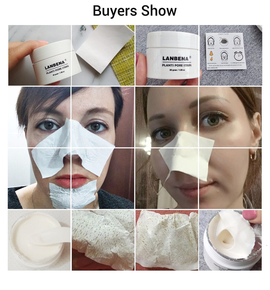 Acne Treatment Mask Skin Care - Klassiichic