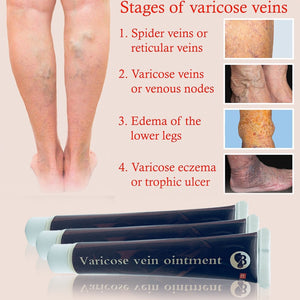 Original Spider Veins Health Care Cream - Klassiichic
