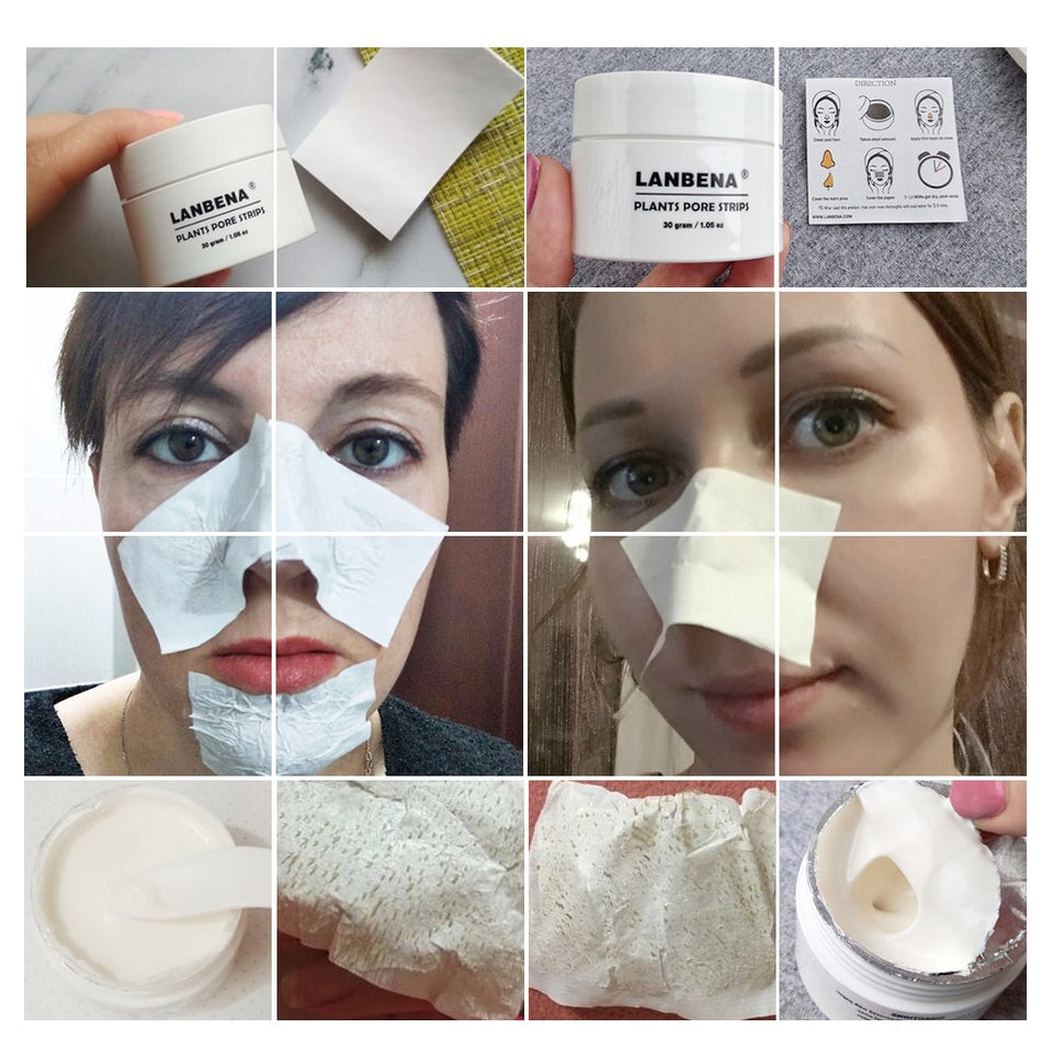 Acne Treatment Mask Skin Care - Klassiichic